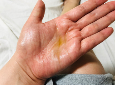 ヴェレダのテクスチャーの写真