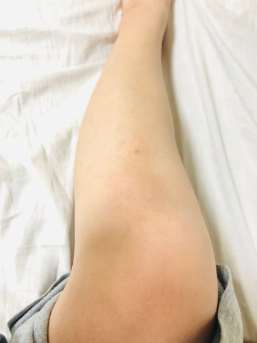 ヴェレダを脚に塗った後の写真