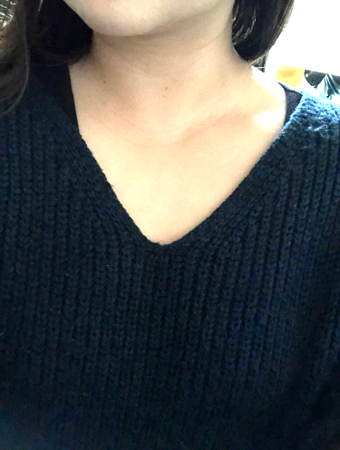 ヴェレダ・ホワイトバーチを使って一週間マッサージした後の写真