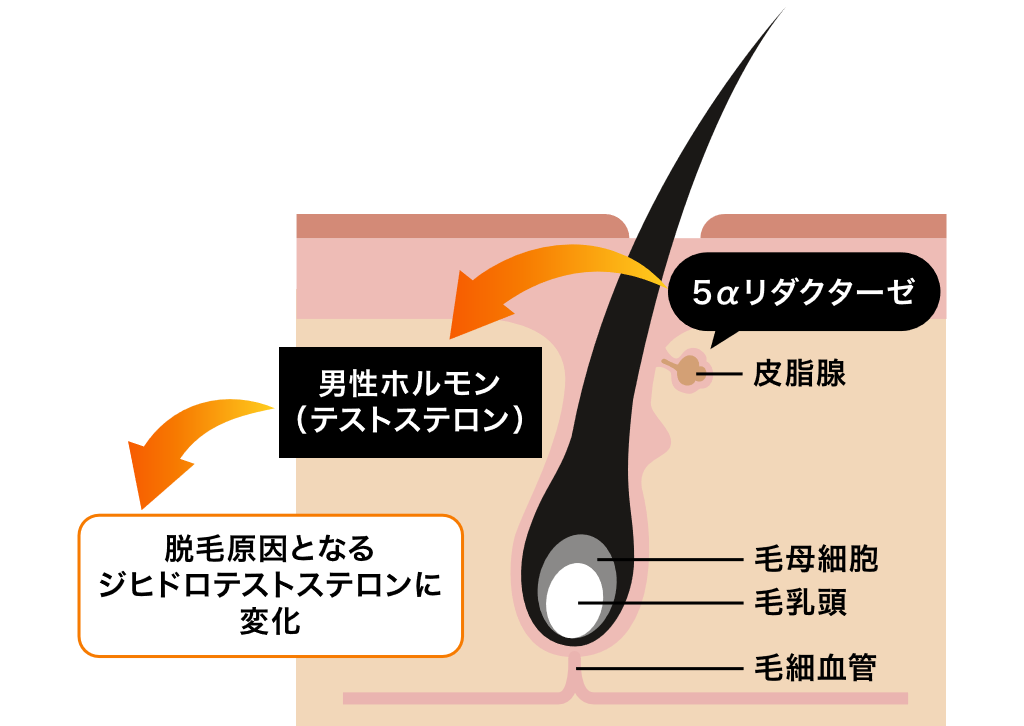 DHTが作用する仕組み