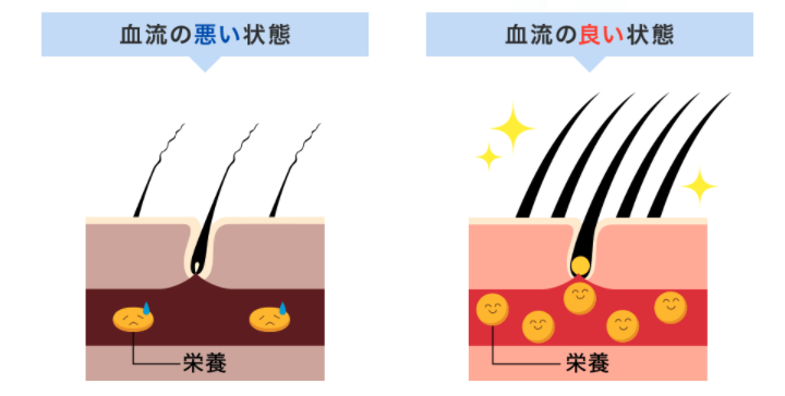 チャップアップ 評判 口コミ 毛の生える仕組み