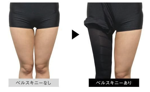 ベルスキニー_効果_みため