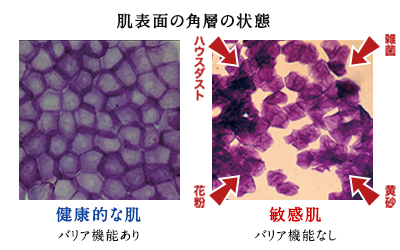 肌表面の角質の状態の写真