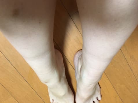 ルートローラー使用前の画像