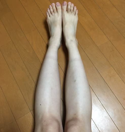 ルートローラー使用前の画像