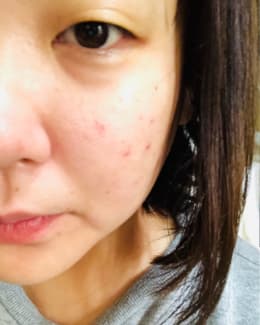 フォトショップリフティングセラム使用前の写真