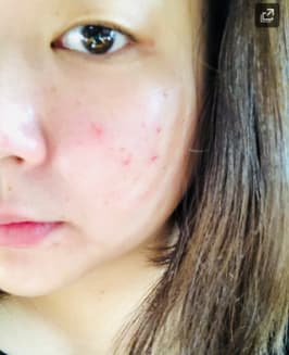 フォトショップリフティングセラム使用後の写真