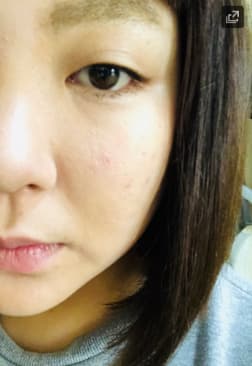 フォトショップリフティングセラム使用後にメイクをした写真