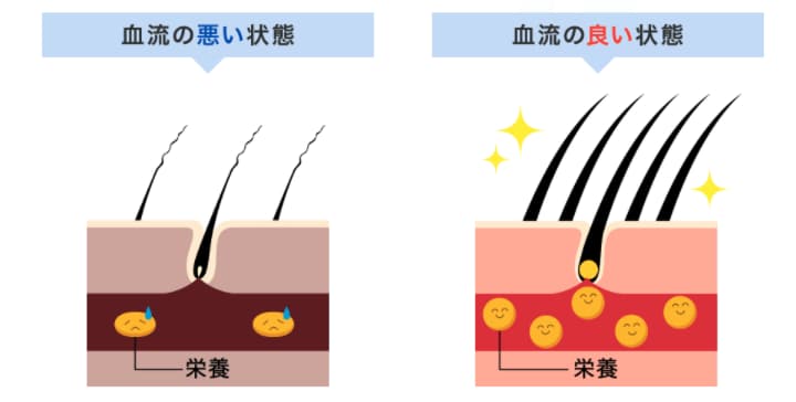 チャップアップ 評判 口コミ 毛の生える仕組み