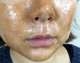 ブラックソープを顔に塗った写真