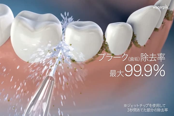 プラーク歯垢が最大99.9％で除去されるという写真