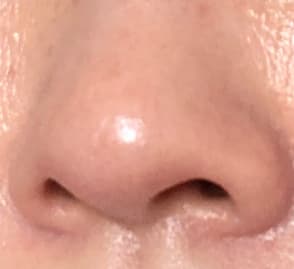 鼻の写真
