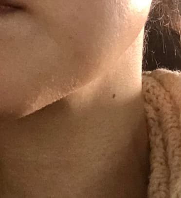 フェイスラインの写真